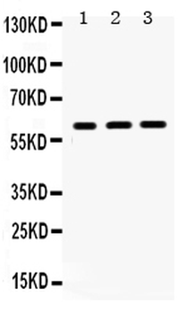 HNF1 beta/HNF1B Rabbit Polyclonal Antibody