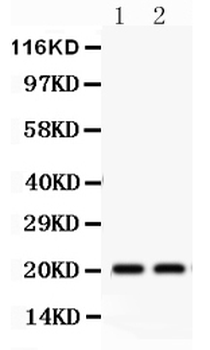 HSPB2 Rabbit Polyclonal Antibody