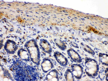 IDH2 Antibody