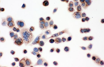 IDH2 Antibody