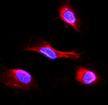 IDH2 Antibody