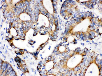 IDH2 Antibody