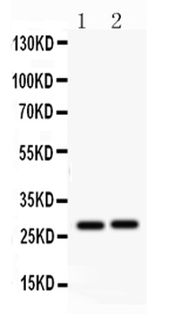 IGFBP1 Rabbit Polyclonal Antibody