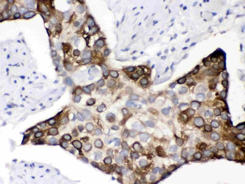 KIN Rabbit Polyclonal Antibody