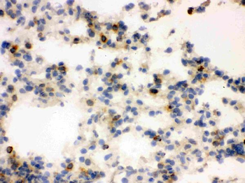 Lipocalin 2/LCN2 Antibody