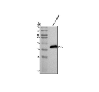 Lipocalin 2/LCN2 Antibody