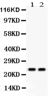Lipocalin 2/LCN2 Antibody