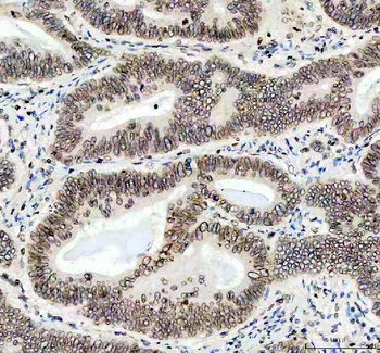 Lamin B1/LMNB1 Antibody