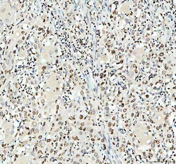 Lamin B1/LMNB1 Antibody