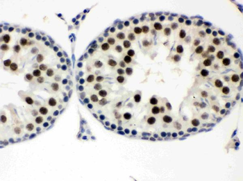 MNAT1 Rabbit Polyclonal Antibody