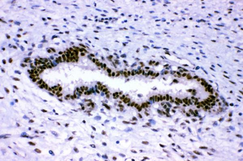p95 NBS1/NBN Antibody