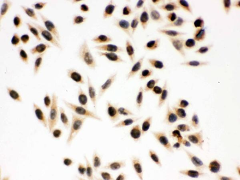 p95 NBS1/NBN Antibody