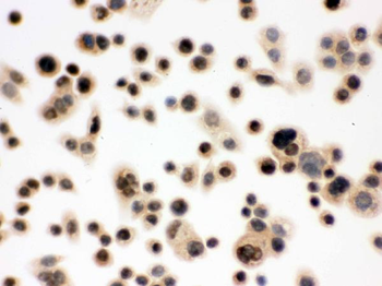 p95 NBS1/NBN Antibody