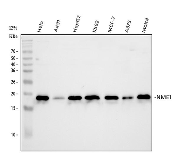 NM23A/NME1 Rabbit Polyclonal Antibody
