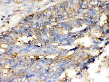 Cofilin/CFL1 Rabbit Polyclonal Antibody