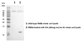 IL8/CXCL8 Rabbit Polyclonal Antibody