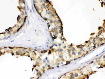Hsp90 alpha/HSP90AA1 Antibody