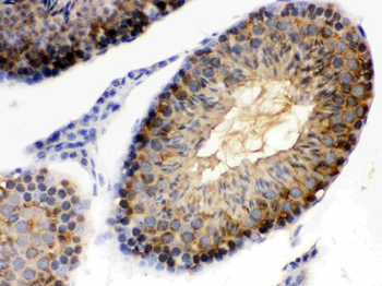 Hsp90 alpha/HSP90AA1 Antibody