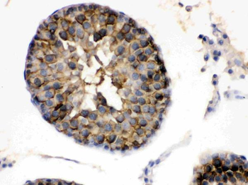 Hsp90 alpha/HSP90AA1 Antibody