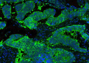 Hsp90 beta/HSP90AB1 Antibody