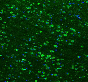 Hsp90 beta/HSP90AB1 Antibody