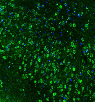 Hsp90 beta/HSP90AB1 Antibody