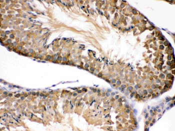 Hsp90 beta/HSP90AB1 Antibody