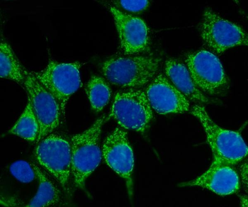 Hsp70/HSPA1A/HSPA1B Rabbit Polyclonal Antibody