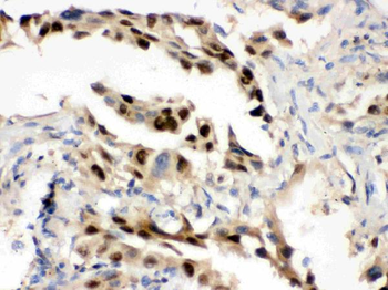 Hsp70/HSPA1A/HSPA1B Rabbit Polyclonal Antibody