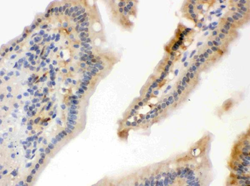 Hsp70/HSPA1A/HSPA1B Rabbit Polyclonal Antibody