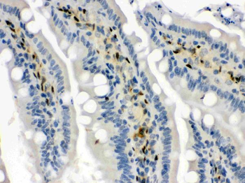 Hsp70/HSPA1A/HSPA1B Rabbit Polyclonal Antibody