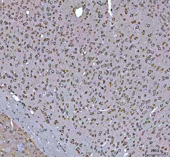 GRP78 BiP/HSPA5 Antibody