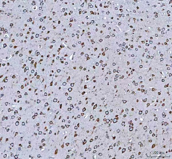 GRP78 BiP/HSPA5 Antibody