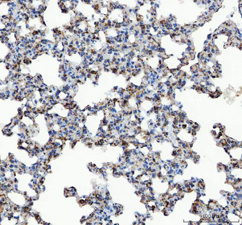 GRP78 BiP/HSPA5 Antibody