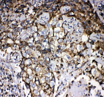 Grp75/HSPA9 Antibody