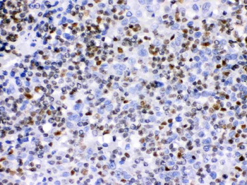 Ikaros/IKZF1 Antibody