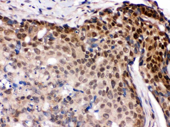 IRF5 Rabbit Polyclonal Antibody