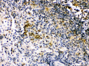 IRF5 Rabbit Polyclonal Antibody