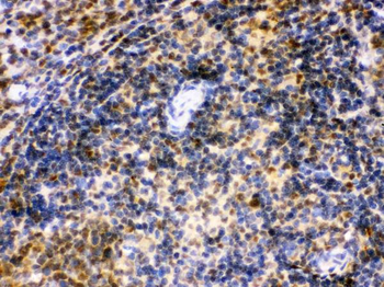 IRF5 Rabbit Polyclonal Antibody
