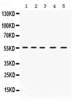 IRF5 Rabbit Polyclonal Antibody