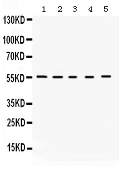 KCNA3 Rabbit Polyclonal Antibody