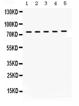 KIF3A Rabbit Polyclonal Antibody