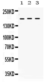 LIFR Rabbit Polyclonal Antibody