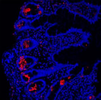 Lysozyme/LYZ Rabbit Polyclonal Antibody