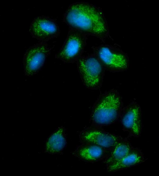 Monoamine Oxidase A/MAOA Rabbit Polyclonal Antibody