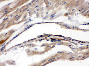 Monoamine Oxidase A/MAOA Rabbit Polyclonal Antibody