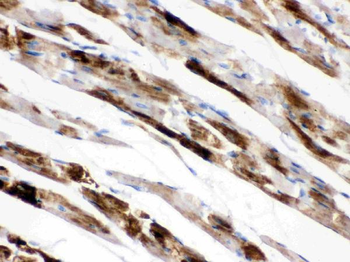 Monoamine Oxidase A/MAOA Rabbit Polyclonal Antibody