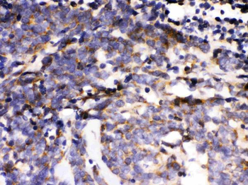 MAPK6 Rabbit Polyclonal Antibody
