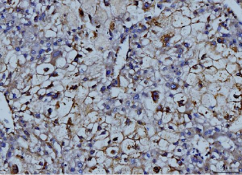 MMP9 Antibody