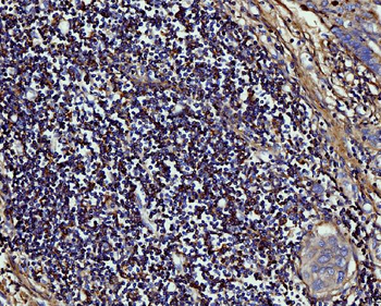 MMP9 Antibody